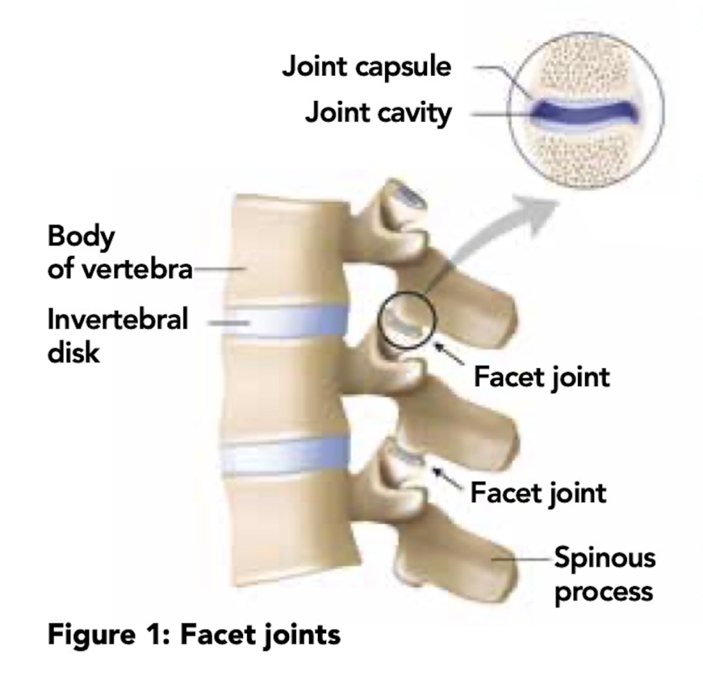 Acute back pain